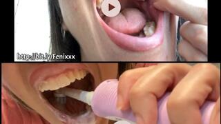 DIRTY MOUTH AFTER EATING and Brushing Teeth