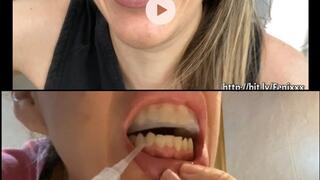 BURCHING WITH A DIRTY MOUTH AND Teeth Whitening