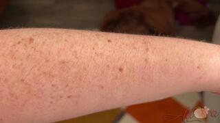 Arm Hair 2 (wmv)