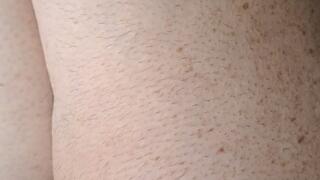 COUNT THE FRECKLES AND YOU SEE THE BLACK HAIR GROWING IN