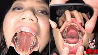 Teeth Obsession Unleashed: The Sensational Video Starring Reina Kitamura