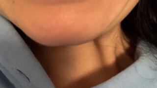 Disgusting crooked teeth