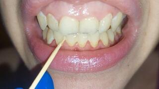 Scratching my teeth with a toothpick