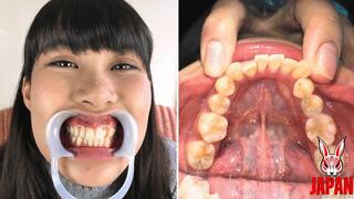 Dental Sensation: Brushing, Sensitivity, and Intrigue, Kotomi Shinozaki