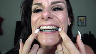 LAUREN'S BRACES & MOUTH TOUR (4K)