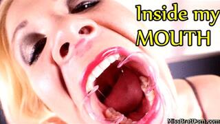 Inside Whitney's Mouth (iPhone)