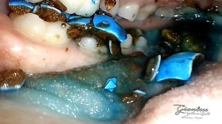 Reverse view chewing inside my mouth