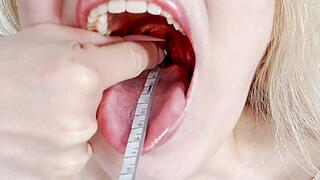 Mouth Measuring CUSTOM