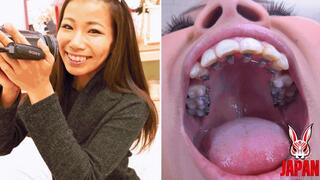 Orthodontic Teeth Fetish : Izumi Asato's Dental Fantasy