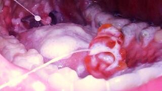 CUSTOM Tiny Spy in My Food