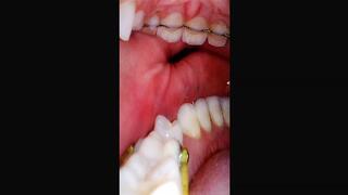 Inside My Mouth Reverse