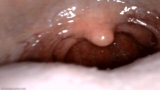 yawning uvula endoscopy