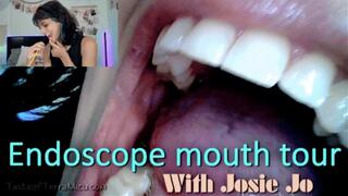 Endoscope Mouth Tour - Josie Jo - HD 720 MP4