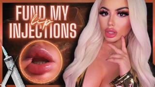 Fund My Lip Injections (1080 WMV)