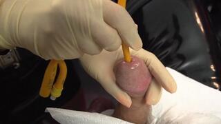 Another Foley Catheter Insertion (White Latex Gloves)