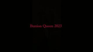 Bunions in nylons