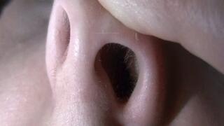 Flaring Nostrils