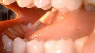 game inside my mouth