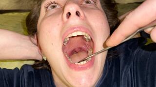 A thorough examination of the deep throat !