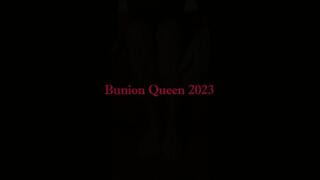 Bunions in front of camera