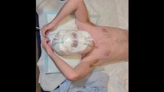 Wet Diaper Hood Treatment #5