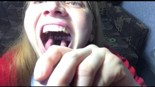 A thorough examination of the deep throat , part 2