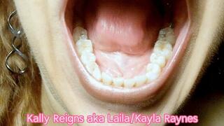 Close Up Mouth and Teeth -Kodak Macro Lens- 117_2539