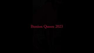 Bunions in pink dress