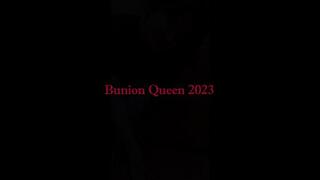 Bunions in blue dress