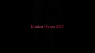 Bunions in pink skirt