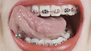 braces close-up with dirty talk (JOI)