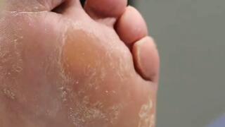 Medical pedicure for your Italian giantess 1080HD