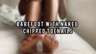 Barefoot Chipped Toenails (mp4)