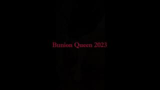 Bunions in pearl dress