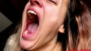 Depressive hypochondriac yawning