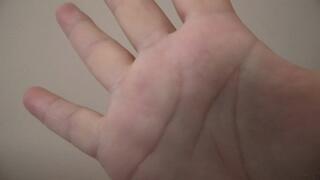 Lines on the palm ORDER