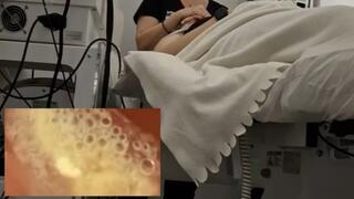 Vore exploration with PillCam at the medical center 4K