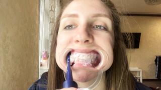 Unusual teeth cleaning