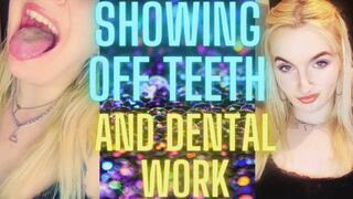 SHOWING OFF TEETH AND DENTAL WORK