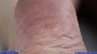 Exploring Frances' Soles