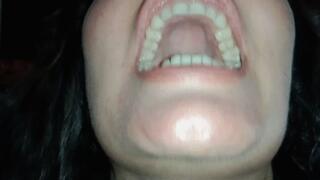 Show my mouth and teeth 8 om