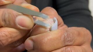 DeCrusting Of De'Feet