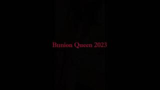 Bunions in bedroom wearing orange dress