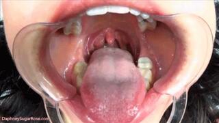 * 854x480p * Cheek Retractor Tongue Tease -Mov