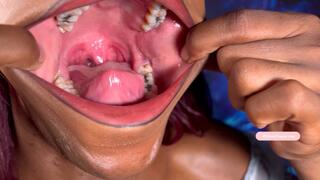 MelaninTongue gives you Another tour of her big wide amazing mouth