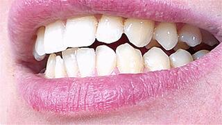 sharp fangs in your mouth