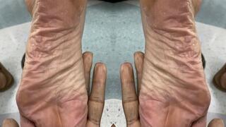 Nike flops and dry soles