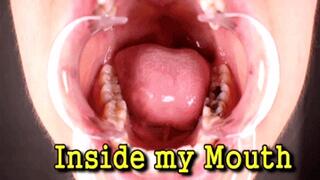 Inside my Mouth (iPhone)