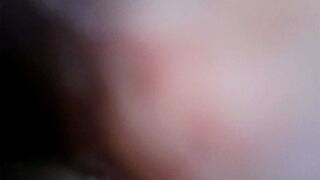 noodles inside stomach endoscope