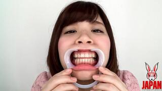 Discovering Hikaru's Dental Delights